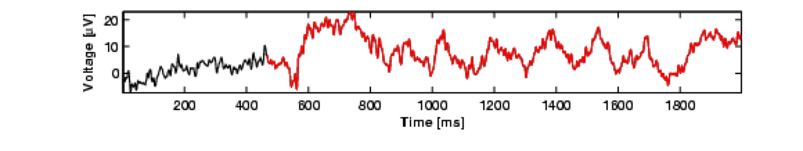 Brain Activity